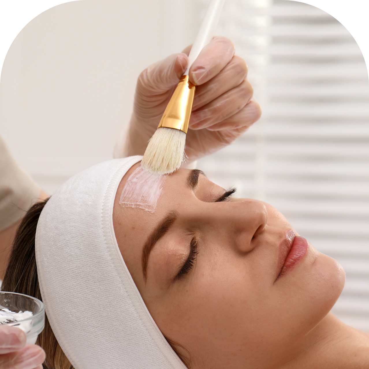 Artic Berry Chemical Peel