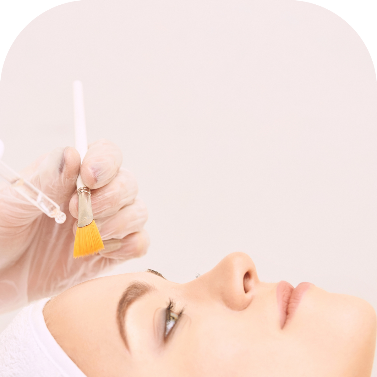Salicylic Acid Chemical Peel