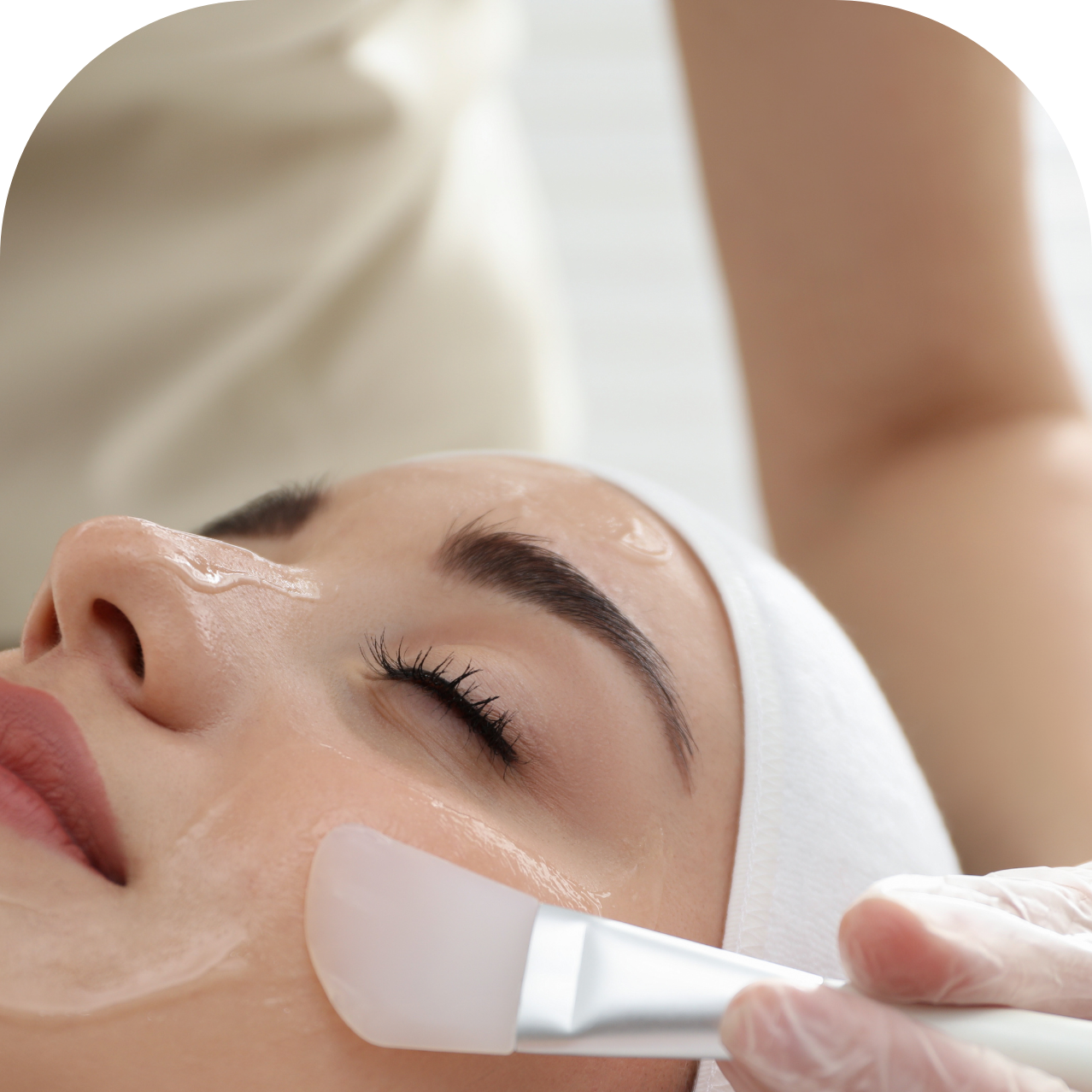 mangosteen Lactic Acid chemical peel
